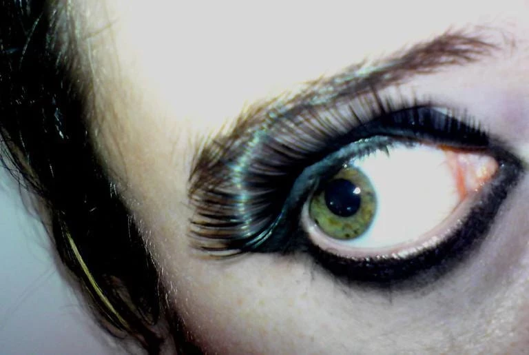 Москвичка обратилась к медикам из-за ожога глаз после наращивания ресниц