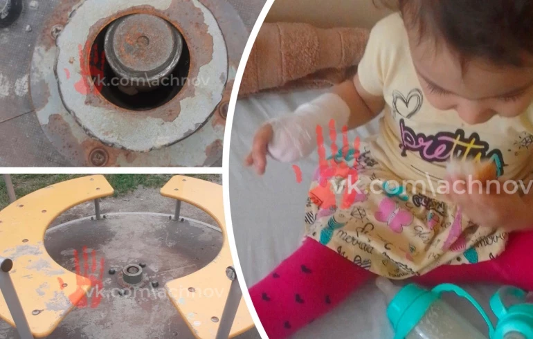 В Челябинске двухлетней малышке оторвало часть пальца на карусели