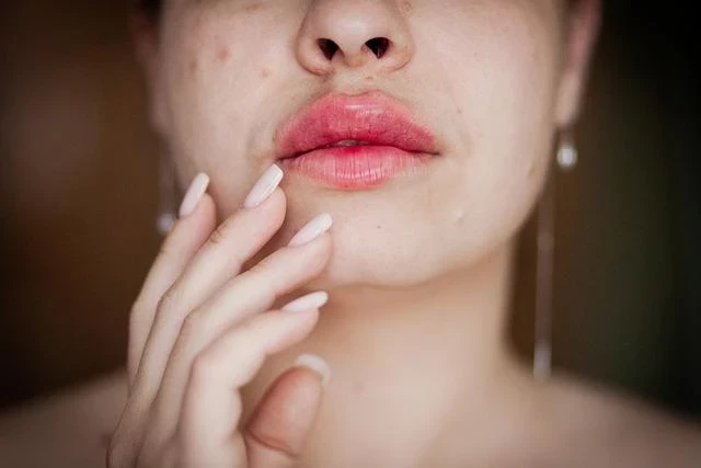 Врач Малиновская опровергла распространенные мифы о герпесе