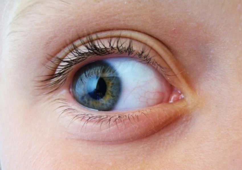 Офтальмологи напомнили об опасности заражения глазным клещом