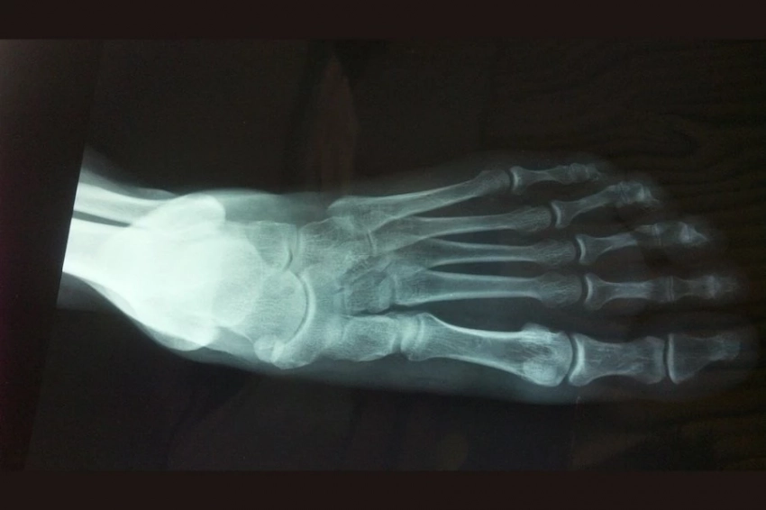 Японский ручной сканер терагерцового диапазона — это «рентген» без вредного излучения