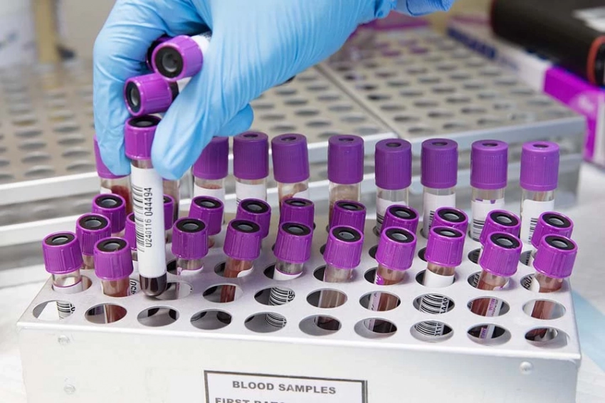 Vaccine: введенная беременным женщинам вакцина от COVID-19 влияет на плод