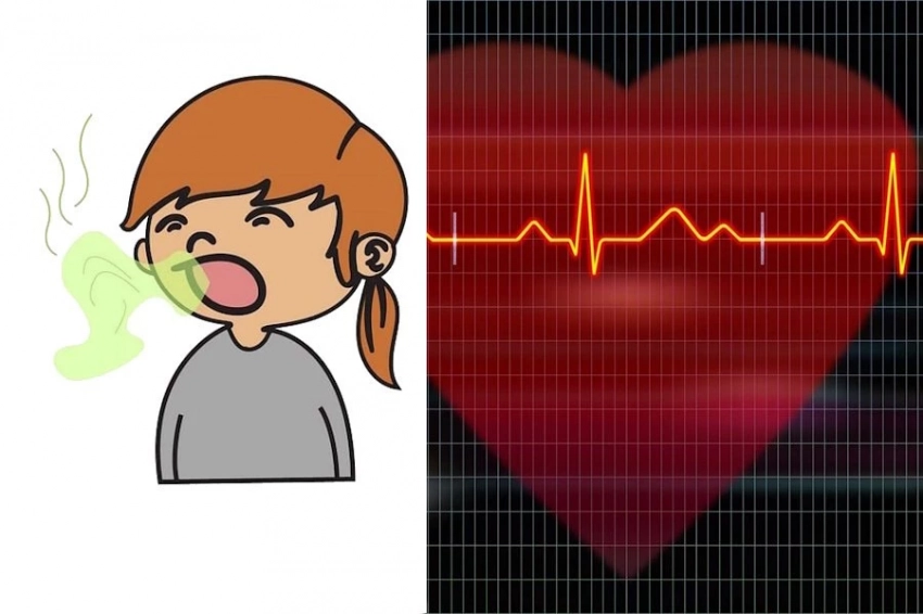 TMDU: пародонтоз повышает риск смертности после инфаркта миокарда