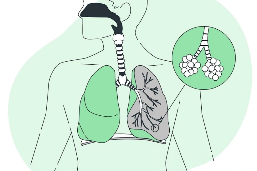 В РФ предлагают использовать кумарины для лечения туберкулеза