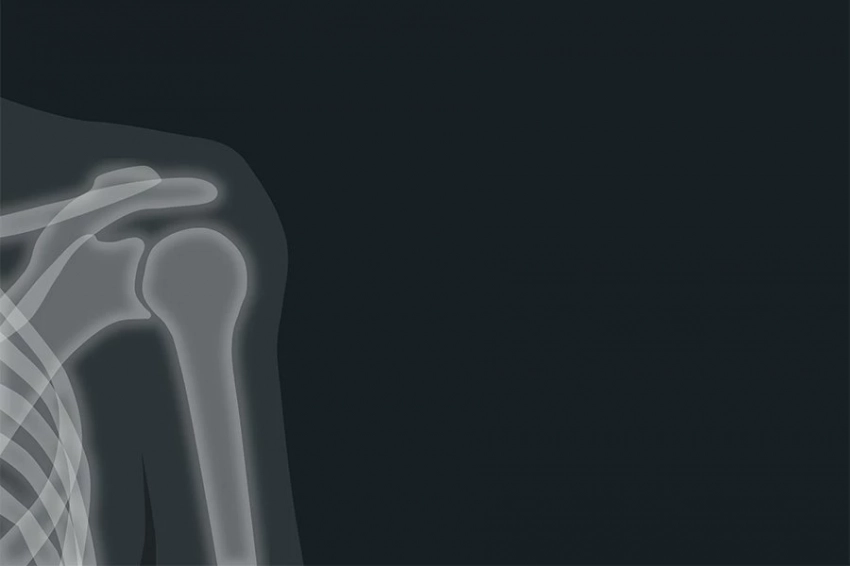 Живший 1,8 миллиона лет назад загадочный гоминид мог быть размером с современного человека