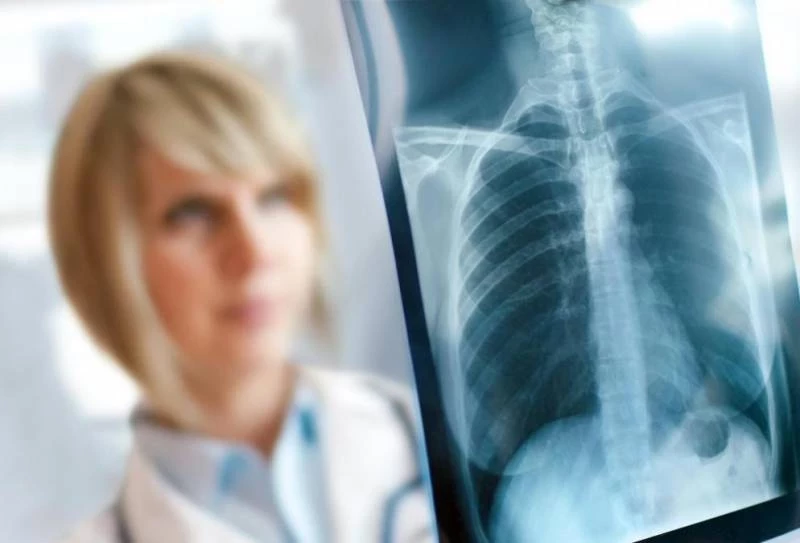 «Чахотка» и «черная оспа»: как медицина победила смертельные болезни прошлого