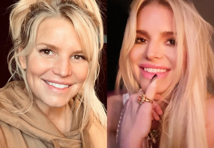 Джессику Симпсон обвинили в злоупотреблении филлерами