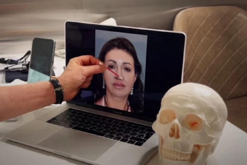 «Я хотела вернуть утраченную красоту»: Алиса Казьмина впервые показала лицо после финальной операции на нос