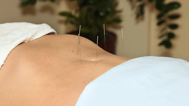 Что такое «точка голода»: работает ли иглоукалывание для снижения веса