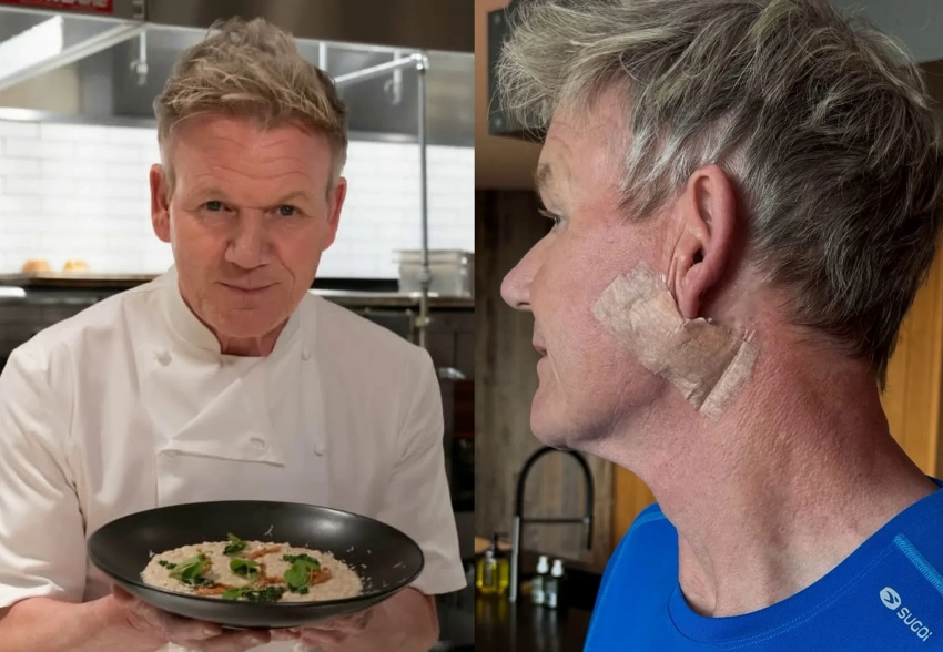 "Не забывайте про солнцезащитный крем". Известный шеф-повар Гордон Рамзи перенес операцию из-за рака кожи